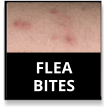 Flea Bites